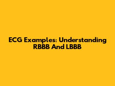 ECG Examples: Understanding RBBB And LBBB