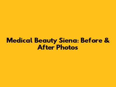 Medical Beauty Siena: Before & After Photos
