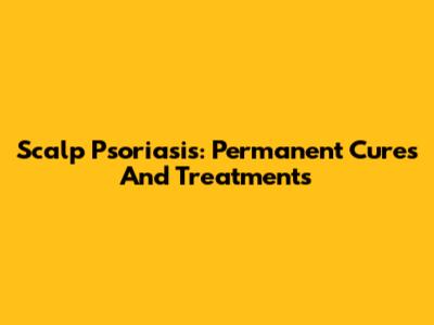 Scalp Psoriasis: Permanent Cures And Treatments