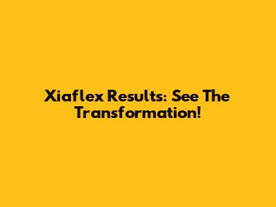 Xiaflex Results: See The Transformation!